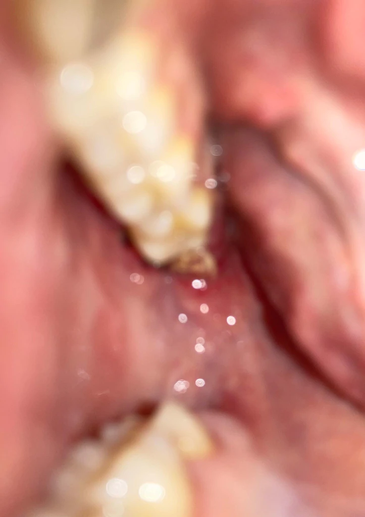 Hole-in-the-Head-Jack-Scollard